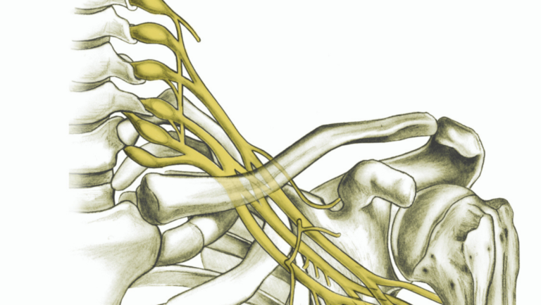 Brachial Plexus Traumatic Nerve Injuries Georgia