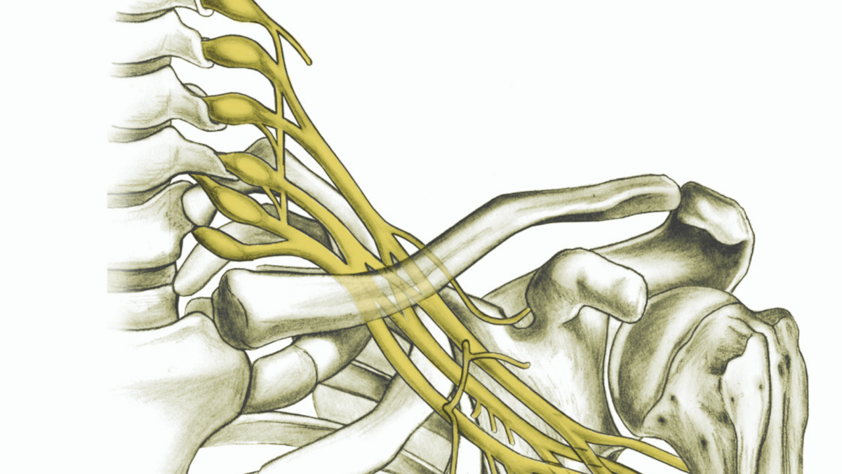 Brachial Plexus: Traumatic Nerve Injuries